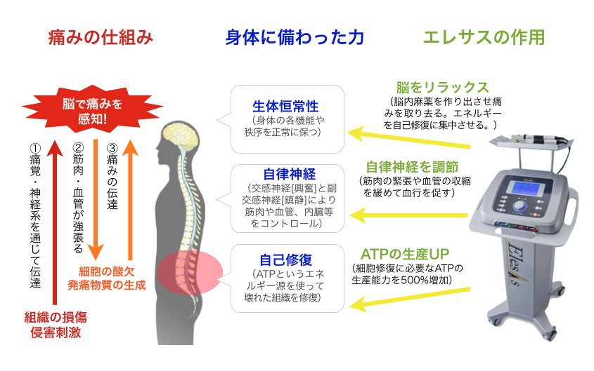 エレサス