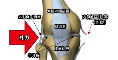 スポーツ主な疾患